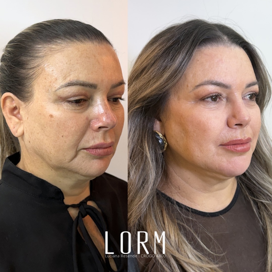 “Eu evitava me olhar de perfil… “Eu evitava me olhar de perfil…