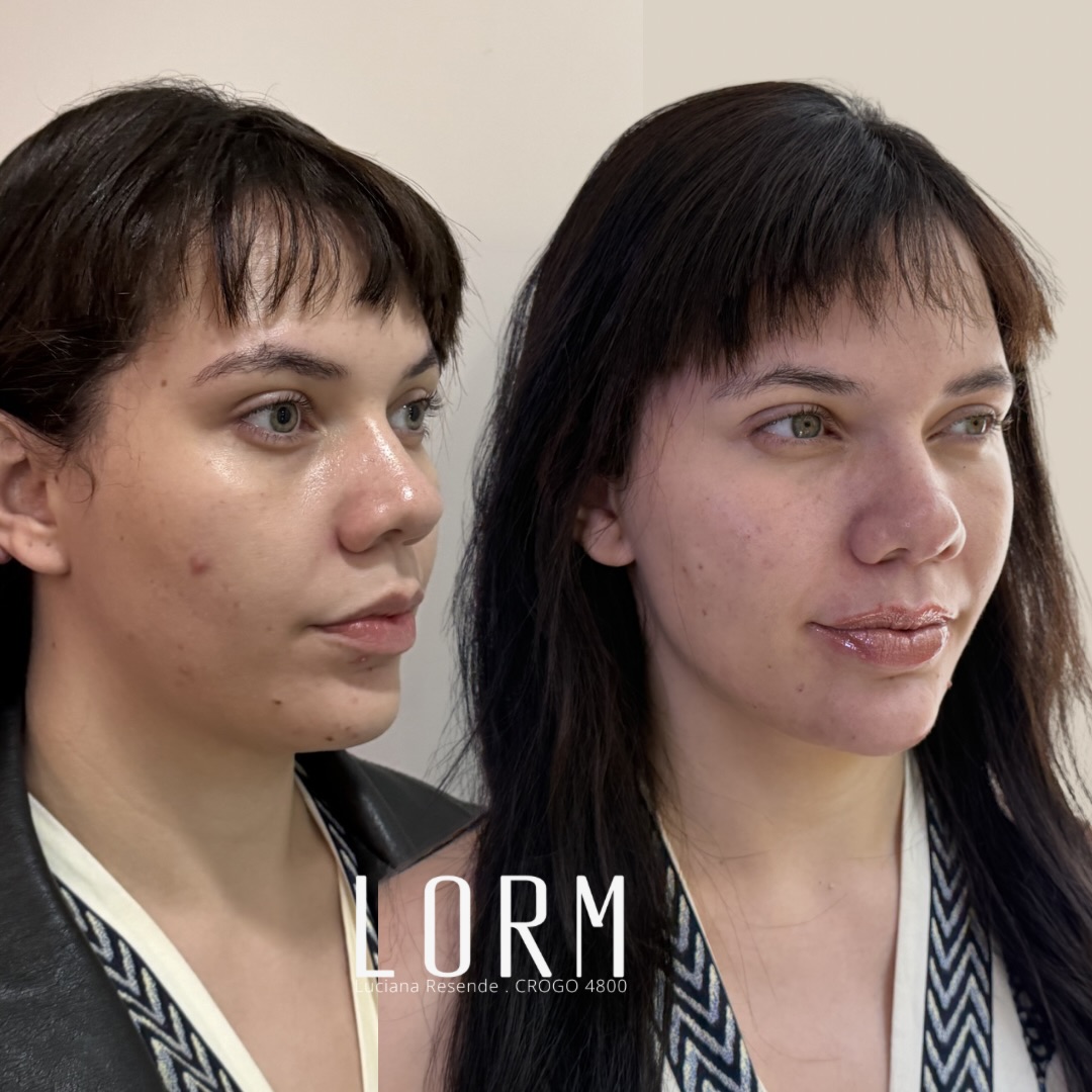 “Uma noiva já brilha naturalme… “Uma noiva já brilha naturalme…
